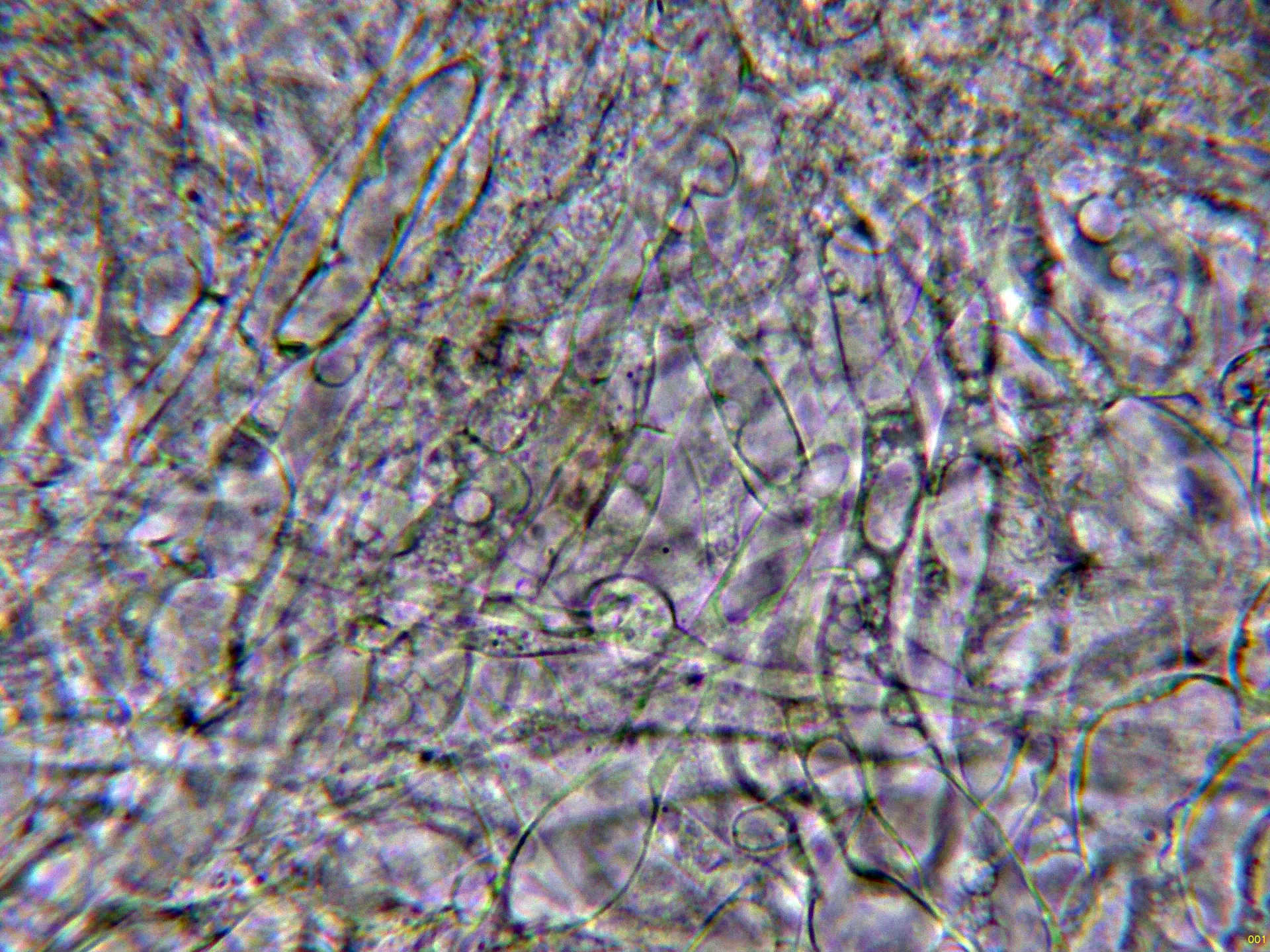 11 - Excípulo medular agua-001